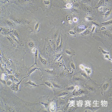 SNU-182 人肝癌细胞