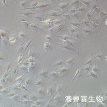 SNU-387 人肝癌细胞