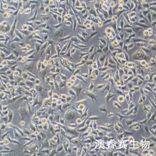 HCC1806 人乳腺鳞状癌细胞（三阴性）