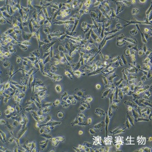 SW 756 人子宫鳞状癌细胞