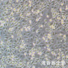 HEEC 人正常食管上皮细胞