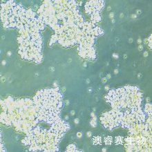 SHP-77 人小细胞肺癌细胞