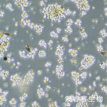 Hut-102 人T淋巴瘤细胞