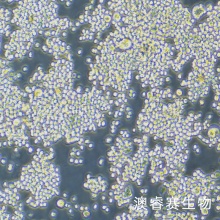 COLO320 人结肠腺癌细胞