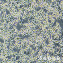 CBRH7919细胞；大鼠肝癌细胞