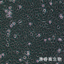 Ovcar 8 人卵巢癌腺癌细胞