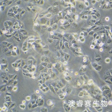 Ovcar 8 人卵巢癌腺癌细胞