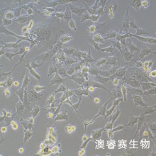 HEY A8 人卵巢癌细胞