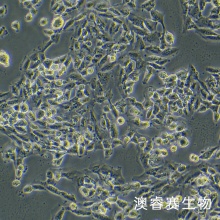 SUM159PT细胞；人乳腺癌细胞