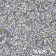 SU-DHL-1细胞 人间变性大细胞淋巴瘤细胞
