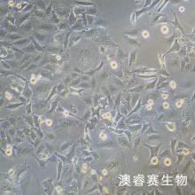 KYSE-520细胞 人食管鳞癌细胞