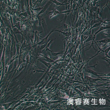 HS888Lu细胞 人肺成纤维细胞