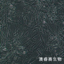 HS888Lu细胞 人肺成纤维细胞