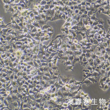 huh-7.5.1细胞 人肝癌细胞