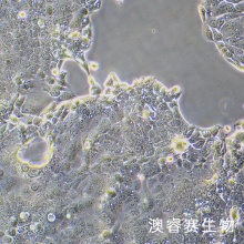 OE-33细胞 人食管腺癌细胞