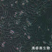 SW1783细胞；人脑星形胶质瘤细胞