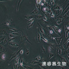 SW1783细胞；人脑星形胶质瘤细胞