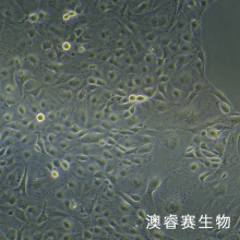 KURAMOCHI细胞 人卵巢癌细胞