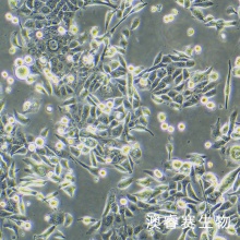 JIMT-1细胞 人乳腺癌细胞