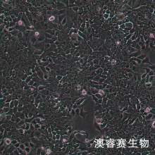 TE-10细胞；人食管癌细胞