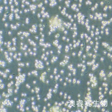 SKM-1细胞；人骨髓增生异常综合征细胞