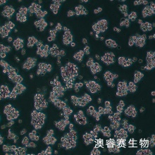 TMD8细胞;人弥漫大B淋巴瘤