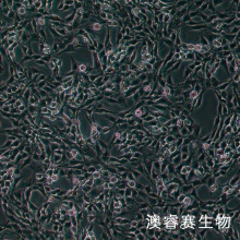 CTX TNA2（大鼠星形胶质细胞）