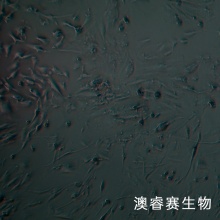 hEM15A；人永生化子宫异位内膜上皮细胞