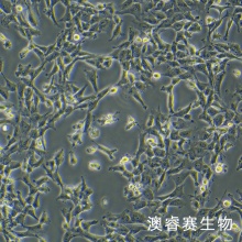 12Z细胞;人源子宫内膜异位细胞