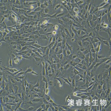 12Z细胞;人源子宫内膜异位细胞