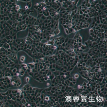 MKU74细胞;人胃癌细胞