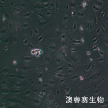 HLEC细胞;人晶状体上皮细胞
