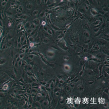 HLEC细胞;人晶状体上皮细胞