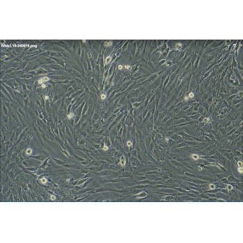 hFOB 1.19（人SV40转染成骨细胞）