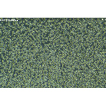 OCI-LY19细胞；人弥漫大B淋巴瘤细胞