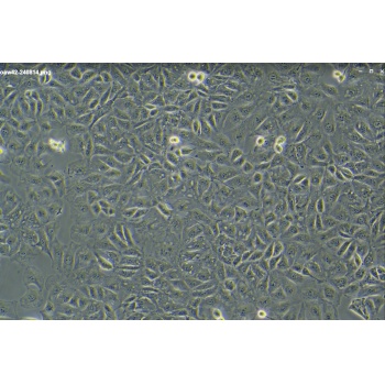 OAW42 卵巢癌细胞