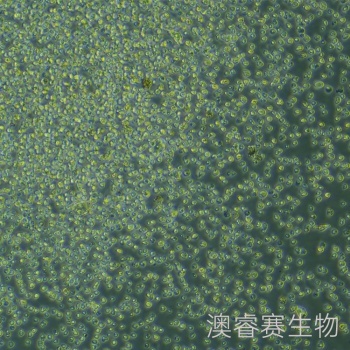 OCI-LY10（人弥漫大B淋巴瘤细胞）