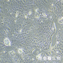 Caco-2（人结直肠腺癌细胞）