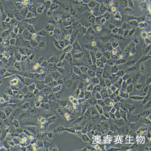 HT-1080 [HT1080]（人纤维肉瘤细胞）