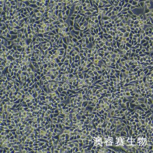 RKO（人结肠腺癌细胞）