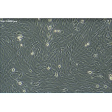 hFOB 1.19（人SV40转染成骨细胞）