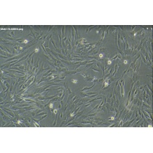 hFOB 1.19（人SV40转染成骨细胞）