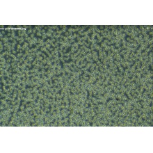 OCI-LY19细胞；人弥漫大B淋巴瘤细胞