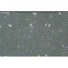 OAW42 卵巢癌细胞