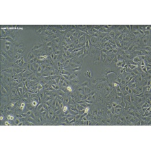 OAW42 卵巢癌细胞