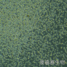 OCI-LY10（人弥漫大B淋巴瘤细胞）