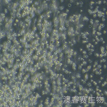 OCI-LY10（人弥漫大B淋巴瘤细胞）