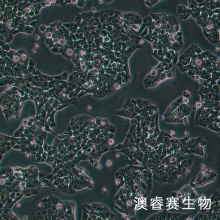 A-673（人横纹肌肉瘤细胞）