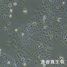 Ca Ski（人宫颈癌肠转移细胞/人宫颈癌上皮细胞）