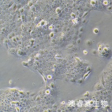 Ca Ski（人宫颈癌肠转移细胞/人宫颈癌上皮细胞）